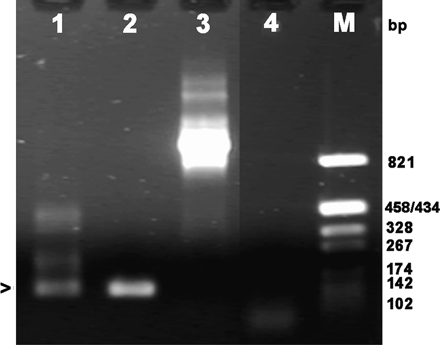 Expression of psoriasin in amniotic membranes. Products of nested RT–PCR resolved by agarose gel electrophoresis. Lane 1: amplicon from an extract of amniotic membranes; the band with the size expected of psoriasin marked with an arrowhead; Lane 2: positive control, rEcoPso plasmid as template; Lane 3: control to show the absence of amplification from genomic DNA; Lane 4: negative control to exclude template contamination of PCR; Lane M: size markers, base pairs (bp).