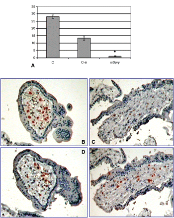 Spry2 siRNA transfection reduced Spry2 expression in villous explants culture. Graphs summarizing three studies showing the reduction of Spry2 expression 72 h post-transfection (A). C, non-treated culture; Csi, non-specific siRNA; siSpry, Spry2 siRNA as determined by quantitative RT–PCR. Results are normalized to the levels of 18S and are presented as mean ± SD fold-change. *P < 0.05 compared with control. Representative immunohistochemistry using anti-Sprouty 2 (B and C) and anti-CD68 (D and E) antibodies on non-treated culture (B and D) and siSpry2 transfected culture (C and E).