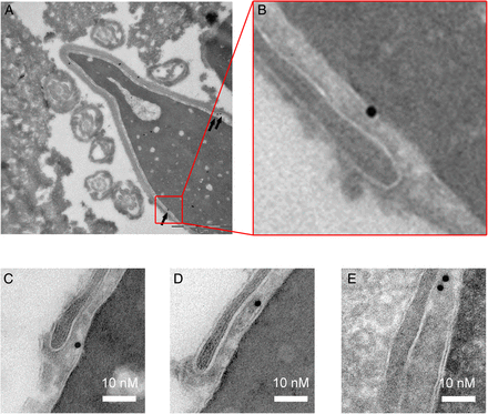 Presence of numerous gold particles at the base of the acrosome vesicle is consistent with immunohistochemistry results showing post-acrosomal localization of PLCζ in human sperm. (A) Gold particles targeting PLCζ antigenic sites were often observed at the base of the acrosome (black arrows) in a control human sperm. (B) Enlargement of the red box drawn in (A). (C–E) Examples of the presence of gold particles in the equatorial segment in different human sperm.