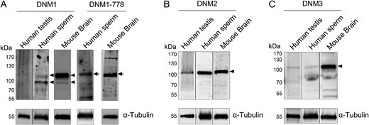 Identification of dynamin isoforms in human testis and sperm lysates. Human testis and sperm lysates were analysed for the presence of (A) dynamin 1 (DNM1), (B) dynamin 2 (DNM2) and (C) dynamin 3 (DNM3) using standard immunoblotting protocols. Mouse brain tissue homogenates were resolved alongside the human samples as a positive control for dynamin expression. After initial dynamin labelling, blots were stripped and re-probed with anti-α-tubulin antibody to confirm equivalent protein loading of each sample. (A) The detection of a doublet of ~100 kDa for DNM1 (arrowheads) prompted a further investigation of the potential for post-translational phosphorylation of this isoform. For this purpose, anti-phospho-DNM1-778 antibody was used to probe the same samples of mouse brain and human sperm lysates, revealing positive labelling of the higher molecular weight band (arrows). These experiments were repeated on spermatozoa obtained from five different healthy normozoospermic donors and representative immunoblots are shown. In contrast, testicular lysates were obtained from a commercial supplier and represent material prepared from a single healthy donor.