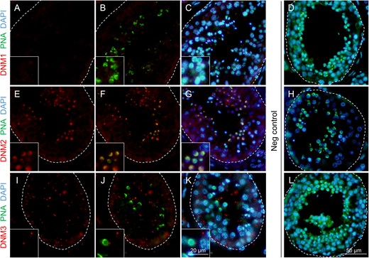 Immunofluorescence detection of dynamin isoforms within the human testis. Antibodies against (A, B and C) DNM1, (E, F and G) DNM2 and (I, J and K) DNM3 were used to determine the localization of these proteins (red) in human testis sections. These sections were subsequently counterstained with PNA (green) and DAPI to reveal the acrosome, and the cell nuclei (blue) of developing germ cells, respectively. For clarity, the structure of seminiferous tubules has been outlined. Among the three dynamin isoforms examined, only DNM2 was found to co-localize with the developing acrosomal vesicle. (D, H and L) The specificity of antibody labelling was confirmed through the inclusion of negative controls (Neg) in which antibody buffer was substituted for the primary antibody. These experiments were replicated on material from three human donors and representative immunofluorescence images are shown. Insets are of equivalent sections shown at higher magnification.