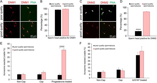 Comparison of dynamin expression in populations of good and poor quality human spermatozoa. Two subpopulations comprising good and poor quality spermatozoa were generated via Percoll density gradient centrifugation of semen from the same donor. (A and B) Immunolabelling of DNM1 revealed an equivalent staining pattern in both good and poor quality subpopulations of mature spermatozoa. (C and D) By contrast, immunolabelling of DNM2 demonstrated an apparent reduction in the amount of this protein in the head of poor quality spermatozoa (arrows) versus that of the good quality subpopulation of cells. Spermatozoa from each of the two subpopulations were induced to acrosome react with either (E) progesterone (15 μM) or (F) calcium ionophore (A23187, 2.5 μM) stimulus. (E and F) The poor quality spermatozoa were significantly compromised (P < 0.0001) in their capacity to complete a progesterone, but not an A23187, induced acrosome reaction compared to good quality spermatozoa. Non-Cap: the spermatozoa in these samples were not capacitated prior to the addition of progesterone or A23187. Cap: the spermatozoa in these samples were capacitated yet received no additional progesterone or A23187 stimulus. Five biological replicates were conducted with quantification of dynamin labelling and acrosomal status being performed across 100 cells per sample. Results are presented as the means ± S.E.M. ****P < 0.0001.