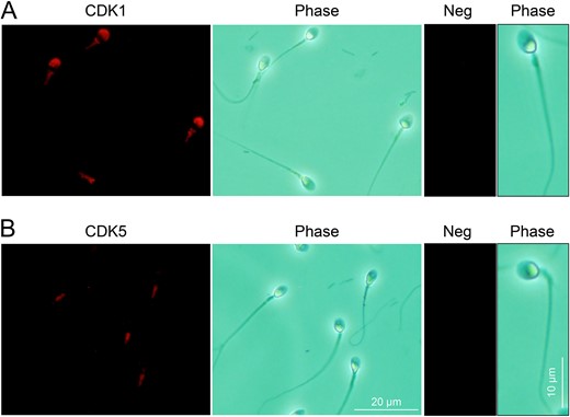 Immunofluorescence detection of cyclin dependent kinases (CDK1 and CDK5) in human spermatozoa. (A) Immunolabelling of human spermatozoa with anti-CDK1 antibodies revealed the strong labelling of the protein within the acrosomal and mid-piece domains. (B) Equivalent immunolabelling with anti-CDK5 antibodies demonstrated a restricted pattern of localization within the mid-piece of the flagellum and no accompanying head labelling. (A and B) The specificity of antibody labelling was confirmed through the inclusion of negative controls (Neg) in which antibody buffer was substituted for the primary antibody. Three biological replicates were conducted and representative images are shown.