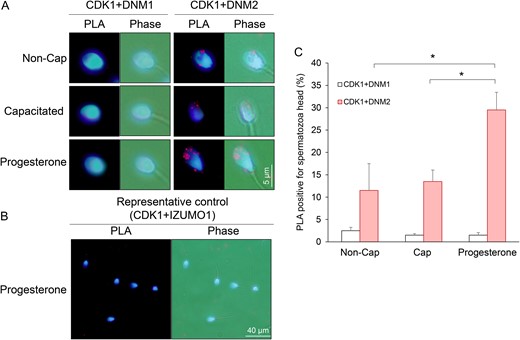 Analysis of CDK1/dynamin 1 and CDK1/dynamin 2 interaction in human spermatozoa. PLAs were applied to investigate the putative interaction between CDK1/DNM1 and CDK1/DNM2 in the anterior region of the human sperm head. This assay generates punctate red fluorescent signals when the targeted pair of proteins reside within a maximum of 40 nm from each other. A threshold of ≥3 red fluorescent spots within the sperm head was set for recording of positive PLA labelling. For clarity, cells were counterstained with the nuclear stain, DAPI. (A) Representative PLA images demonstrating that CDK1 resides in close proximity to DNM2, but not DNM1, in the anterior region of the sperm head. (B) The specificity of this interaction was confirmed through the use of antibodies targeting IZUMO1, a protein that is not expected to be a substrate of CDK1. (C) Data from this assay were quantified by recording the percentage of PLA positive spermatozoa, with 100 cells being examined per sample. Experiments were conducted on five biological replicates and the results are presented as the means ± S.E.M. *P < 0.05 compared to progesterone treatment (CDK1/DNM2).