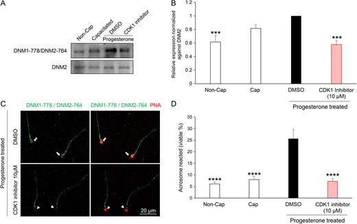 Pharmacological inhibition of CDK1 reduces dynamin phosphorylation and the ability of human spermatozoa to acrosome react. (A) Immunoblotting of lysates prepared from human spermatozoa incubated with CDK1 inhibitor (10 μM) revealed a reduction in the progesterone stimulated phosphorylation of DNM1-778/DNM2-764 residues compared to that cells treated with the vehicle alone (DMSO). Blots were stripped and re-probed with anti-DNM2 antibody to confirm equivalent levels of DNM2 in each sample. (B) The intensity of DNM1-778/DNM2-764 labelling was quantified by Image J and normalized to DNM2 levels. (C) Immunofluorescent labelling of spermatozoa confirmed that the reduction in DNM1-778/DNM2-764 phosphorylation was restricted to the anterior (acrosomal) region of the sperm head (coinciding with the location of CDK1). (D) CDK1 inhibition also led to a significant reduction (P < 0.01) in the number of acrosome reacted cells following treatment with progesterone when compared to the vehicle only control (DMSO). All experiments were conducted on five biological replicates and the results are presented as the means ± S.E.M. ***P < 0.001; ****P < 0.0001 compared to DMSO vehicle control.