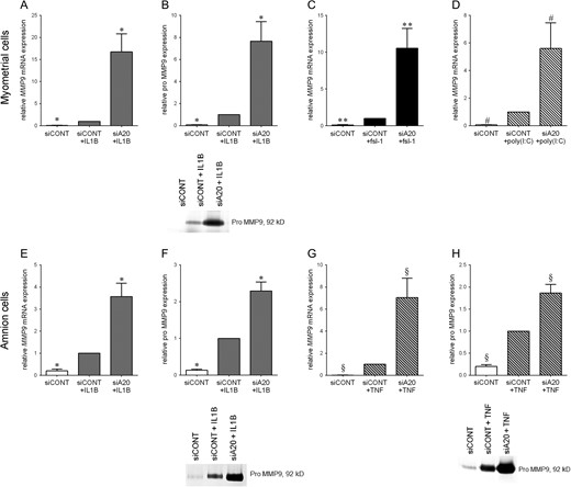 Effect of siA20 on MMP9 in primary myometrial and amnion cells. Human primary (A–D) myometrial or (E–H) amnion cells were transfected with 50 nM siCONT or 50 nM siA20 for 48 h and then treated with (A,B,E,F) 1 ng/ml IL1B, (C) 250 ng/ml fsl-1, (D) 5 μg/ml poly(I:C) or (G,H) 10 ng/ml TNF for an additional 20 h (n = 5 patients). (A,C-E,G) MMP9 mRNA expression was analysed by qRT-PCR. (B,F,H) The concentration of pro-MMP9 in the incubation medium was assayed by zymography. Representative zymography images from one patient are also shown. For all data, the fold change was calculated relative to IL1B-, fsl-1- poly(I:C)-or TNF-stimulated siCONT transfected cells, and displayed as mean ± SEM. *P < 0.05 vs. IL1B-stimulated siCONT transfected cells (one-way ANOVA); **P < 0.05 vs. fsl-1-stimulated siCONT transfected cells (one-way ANOVA); #P < 0.05 vs. poly(I:C)-stimulated siCONT transfected cells (one-way ANOVA); §P < 0.05 vs. TNF-stimulated siCONT transfected cells (one-way ANOVA).