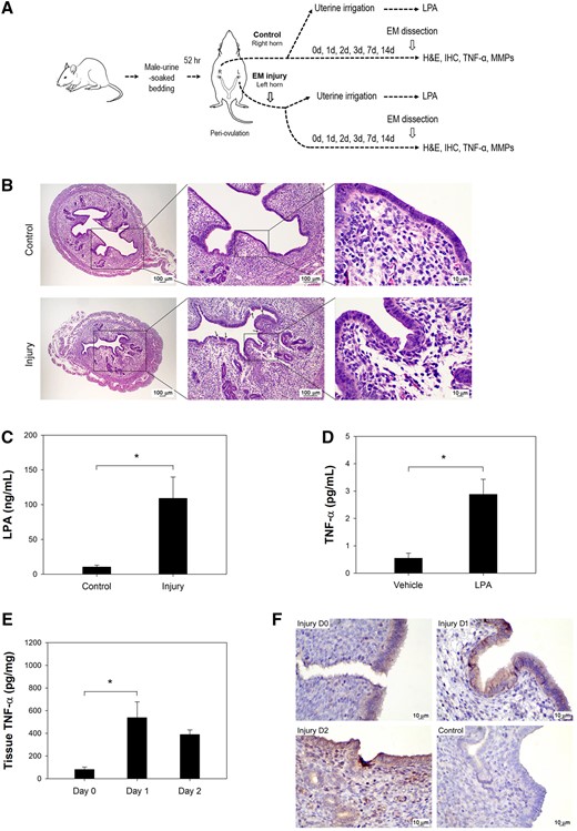 Endometrial injury induced LPA and TNF-α. (A) A diagram of the protocol used in the mouse experiments. (B) H&E staining of the mouse endometrium from an injured horn and control horn is shown (left panel, magnification 40×; middle panel, magnification 100×; right panel, magnification 400×). The presence of cracks in the luminal epithelium (arrows) was visible in the injured edematous endometrium. (C) LPA concentrations in the mouse uterine washing medium at 30 min post-injury showed much higher levels (P = 0.043). (D) TNF-α expression was more prominent in human endometrial epithelial cells (hEEpCs) treated with 10 µM LPA (P = 0.004). (E) Mouse endometrial TNF-α levels increased significantly on Days 1 and 2 post-injury (P = 0.030). (F) Immunohistochemistry demonstrated more prominent TNF-α stain in the endometrium on Days 0, 1 and 2 after injury than in uninjured endometrium (magnification 400×). Mouse isotype IgG was used as control. *Significant.