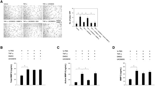 In vitro tube formation assay and the regulation of MMP-3 and MMP-9. (A) Tube formation assay demonstrated enhanced angiogenesis of hEEnCs after the addition of rhTNF-α-treated hEEpCs culture medium (P = 0.002). This enhanced angiogenesis was blocked by UK356618, an MMP-3 inhibitor (P = 0.014). This was mitigated by the addition of active rhMMP-9 (P = 0.043), but not of inactive rhMMP-9 (P = 0.014). BSA: bovine serum albumin. (B, C, D) Levels of total and active MMP-9 (P=0.003 and P = 0.0001, respectively) and MMP-3 (P = 0.044) were significantly increased after the stimulation with TNF-α, and the level of active MMP-9 is downregulated after the addition of UK356618 (P = 0.0008). DMSO, Dimethyl sulfoxide. *Significant.