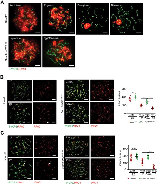 Spermatocytes of Shoc1 cKOStra8-Cre male mice exhibited defective meiotic recombination. (A) Representative chromosome spreads from adult Shoc1f/f and Shoc1 cKOStra8-Cre spermatocytes stained with SYCP3 (green) and γH2AX (red) antibodies. Scale bars = 10 µm. Red arrows indicate the sex chromosomes. (B) Chromosome spreads of adult Shoc1f/f and Shoc1 cKOStra8-Cre spermatocytes immunostained for SYCP3 (green) and RPA2 (red). Representative images are presented. Scale bar = 10 µm. Quantification of the foci numbers of RPA2 in adult Shoc1f/f and Shoc1 cKOStra8-Cre spermatocytes are shown on the right. EP, early-pachytene; EZ, early-zygotene; LZ, late-zygotene; Z-like, zygotene-like. (C) Detection of recombinase DMC1 in chromosome spreads of adult Shoc1f/f and Shoc1 cKOStra8-Cre spermatocytes by immunostaining with antibodies against SYCP3 (green) and DMC1 (red). Representative images are presented. The white arrow indicates XY chromosomes. Scale bar = 10 µm. Quantification of the foci numbers of DMC1 in adult Shoc1f/f and Shoc1 cKOStra8-Cre spermatocytes are shown on the right. Statistical analysis was performed using two-tailed Student’s t-tests: **P < 0.01; ***P < 0.001; n.s., not significant. Error bars indicate SEM. n: number of spermatocytes analyzed from three independent experiments. Spermatocyte spreads for these experiments were obtained from three mice for each genotype. cKO, conditional knockout.