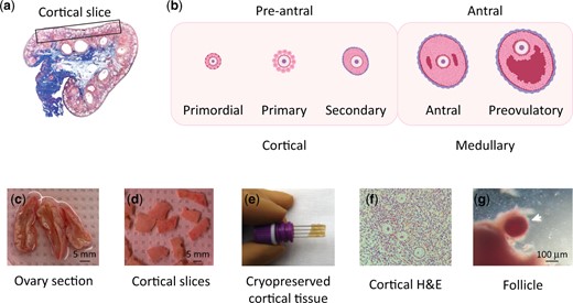 Schematic of study to measure chromatin accessibility from human follicles. (a) Drawing of human ovary section. Representative cortical tissue was dissected from the boxed area. (b) Schematic of follicle maturation. Follicles collected for study were primarily primordial, primary and early secondary. (c–g) Fresh ovary processing. (c) Tissue was obtained as ∼8 mm diameter ovarian slices. (d) Ovarian cortical pieces were dissected into 5–10 mm×10 mm×1 mm pieces. (e) Cryopreservation of cortical tissue. (f) H&E staining of pre-antral follicles in sections from cortical pieces. (g) Dissection of follicle from cortical piece for downstream Assay for Transposase Accessible Chromatin by sequencing (ATAC-seq). Note: Follicle was removed from surrounding tissue before processing.