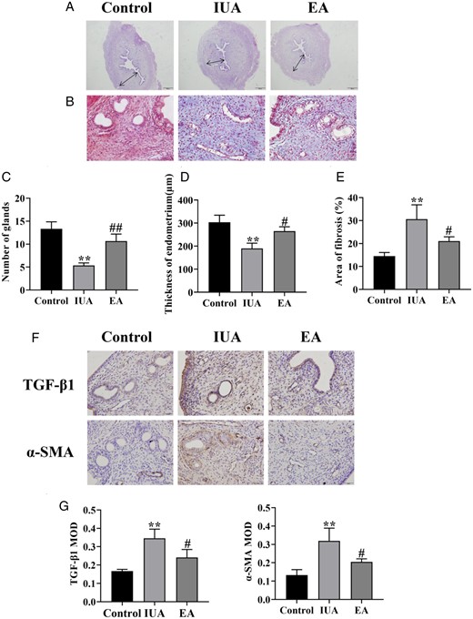 Comparison of endometrial morphology in rats. (A) Hematoxylin–eosin staining of rat uterine tissue (×40). (B) Masson’s staining shows endometrial fibrosis (×400). (C) Number of endometrial glands. (D) Endometrial thickness. (E) Endometrial fibrosis area. (F) Immunohistochemistry staining of TGF-β1 and α-SMA in endometrial tissues (×400). (G) The average MOD values of TGF-β1 and α-SMA. A one-way ANOVA was used to conduct comparisons among groups. Data are represented as the mean ± SEM (n =3). **P < 0.01, compared to the control group; #P < 0.05 and ##P < 0.01, compared to the model group. TGF-β1: transforming growth factor-β1; α-SMA: alpha-smooth muscle actin; MOD: mean optical density; IUA: intrauterine adhesion; EA: electroacupuncture.