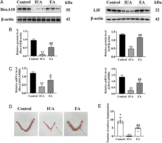 Electroacupuncture improves endometrial receptivity in a rat model. (A) HoxA10 and LIF protein bands were determined by western blot. The uncropped versions of these blots are presented in Supplementary Fig. S4. (B) Relative expression level of HoxA10 and LIF (n =3). (C) HoxA10 and LIF mRNA expression were analyzed by q-PCR (n =3). (D) Representative diagrams of embryos on Day 8 of pregnancy, with the arrow denoting the uterus after endometrial injury. (E) Number of embryo implantations in the damaged uterus (n =5). A one-way ANOVA was used to conduct comparisons among groups. Data are represented as the mean ± SEM. **P < 0.01, compared to the control group; #P < 0.05 and ##P < 0.01, compared to the model group. HoxA10: homeobox A10; LIF: leukemia inhibitory factor; IUA: intrauterine adhesion; EA: electroacupuncture.
