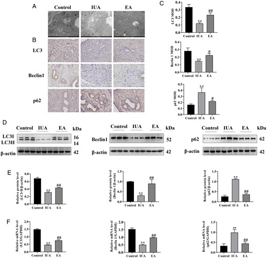 Electroacupuncture rescues impaired autophagy in the rat endometrium. (A) The autophagosomes of endometrial epithelial cells were observed by TEM. Arrowheads indicate autophagosomes. Scale bars: 5 μm. (B) Immunohistochemistry staining of LC3, Beclin1, and p62 proteins in endometrial tissues (×400). (C) The average MOD values of LC3, Beclin1, and p62 were calculated. (D) LC3, Beclin1, and p62 protein bands were determined by western blot. The uncropped versions of these blots are presented in Supplementary Fig. S5. (E) Relative protein expression levels of LC3, Beclin1, and p62. (F) LC3, Beclin1, and p62 mRNA expression were analyzed by q-PCR. A one-way ANOVA was used to conduct comparisons among groups. Data are represented as the mean ± SEM (n = 3). **P < 0.01, compared to the control group; #P < 0.05 and ##P < 0.01, compared to the model group. TEM: transmission electron microscopy; LC3: microtubule-associated protein 1 light chain 3; MOD: mean optical density; IUA: intrauterine adhesion; EA: electroacupuncture.