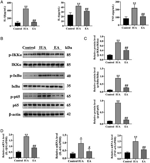 Electroacupuncture inhibits endometrial inflammation in rats with intrauterine adhesion. (A) IL-1β, IL-6, and TNF-α in endometrial tissue were detected by ELISA. (B) The phosphorylation levels of IKKα, IκBα, and p65 protein bands were determined by western blot. The uncropped versions of these blots are presented in Supplementary Fig. S6. (C) Relative level of IKKα, IκBα, and p65 protein expression. (D) IL-1β, IL-6, and TNF-α mRNA expression were analyzed by q-PCR. A one-way ANOVA was used to conduct comparisons among groups. Data are represented as the mean ± standard error (SEM) (n = 3). *P < 0.05 and **P < 0.01, compared to the control group; #P < 0.05 and ##P < 0.01, compared to the model group. IL: interleukin; TNF-α: tumor necrosis factor-alpha; IKKα: inhibitor of Kappa B Kinase alpha; IKBα: inhibitor of kappa B alpha; IUA: intrauterine adhesion; EA: electroacupuncture.