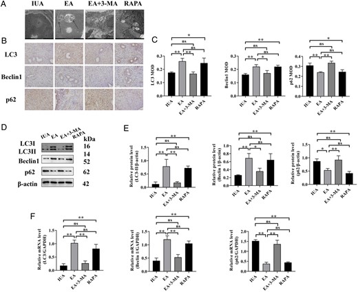 Endometrial autophagy of rats in each group. (A) The autophagosomes of endometrial epithelial cells were observed by TEM. Arrowheads indicate autophagosomes. Scale bars: 5μm. (B) Immunohistochemistry staining of LC3, Beclin1, and p62 proteins in endometrial tissues (×400). (C) The average MOD values of LC3, Beclin1, and p62 were calculated. (D) LC3, Beclin1, and p62 protein bands were determined by western blot. The uncropped versions of these blots are presented in Supplementary Fig. S7. (E) Relative expression levels of LC3, Beclin1, and p62. (F) LC3, Beclin1, and p62 mRNA expression were analyzed by q-PCR. A one-way ANOVA was used to conduct comparisons among groups. Data are represented as the mean ± SEM (n = 3). *P < 0.05 and **P < 0.01, ns: no significance. TEM: transmission electron microscopy; LC3: microtubule-associated protein 1 light chain 3; MOD: mean optical density; IUA: intrauterine adhesion; EA: electroacupuncture 3-MA: 3-methyladenine; RAPA: rapamycin.