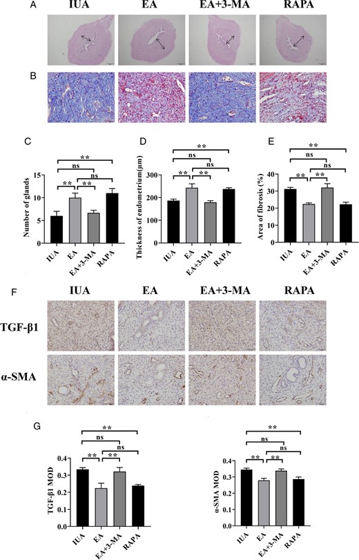 Endometrial repair effect for rats in each group. (A) H&E staining of rat uterine tissue (×40). (B) Masson’s staining shows endometrial fibrosis (×400). (C) Number of endometrial glands. (D) Endometrial thickness. (E) Endometrial fibrosis area. (F) Immunohistochemistry staining of TGF-β1 and α-SMA in endometrial tissues (×400). (G) The average MOD values of TGF-β1 and α-SMA. A one-way ANOVA was used to conduct comparisons among groups. Data are represented as the mean ± standard error (SEM) (n = 3). **P < 0.01, ns: no significance. TGF-β1: transforming growth factor-β1; α-SMA: alpha-smooth muscle actin; MOD: mean optical density; IUA: intrauterine adhesion; EA: electroacupuncture; 3-MA: 3-methyladenine; RAPA: rapamycin.