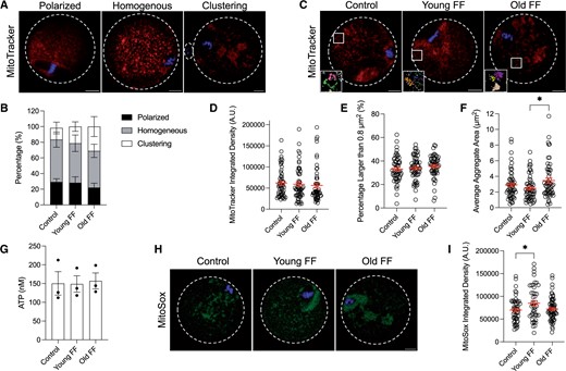 Follicular fluid (FF) increases size of mitochondrial aggregates in an age-dependent manner. (A) Representative middle z-slices of different mitochondrial distributions in metaphase II mouse eggs. Mitochondria (MitoTracker, red) and DNA (Hoechst, blue) were visualized by live cell dyes. Dashed lines outline the perimeter of eggs and polar bodies if visible in z-slice. Scale bars = 10 µm for all panels. (B) Quantification of mitochondrial distribution for eggs following maturation without FF (control), in young FF, or in old FF. Data are shown as mean±SEM for all panels. N = 54–58 eggs per group across total of three trials. (C) Representative middle z-slice of eggs following maturation without FF (control), in young FF, or in old FF. Mitochondria and DNA visualized as in (A). Boxed regions are magnified in insets. Insets show representative mitochondrial aggregates following thresholding as quantified in (F). Each color corresponds to one aggregate and particles below the minimum size for quantification are displayed in white. Scale bar (gray)=1 µm. (D–F) Quantification of mitochondrial integrated density in arbitrary units (A.U.; D), percentage of mitochondrial aggregates larger than 0.8 µm2 (E), and average mitochondrial aggregate area (F). *P-value ≤0.05 by one-way ANOVA with multiple comparisons. N = 54–58 eggs per group across total of three trials. (G) Quantification of ATP concentration in eggs following maturation without FF (control), in young FF, or in old FF. Each data point represents the average of two wells (each containing 20 eggs) from one experiment. N = 120 eggs per group across total of three trials. (H) Representative middle z-slice of eggs following maturation without FF (control), in young FF, or in old FF. Mitochondrial superoxide (MitoSox, green) and DNA (Hoechst, blue) were visualized by live cell dyes. (I) Quantification of mitochondrial superoxide integrated density in arbitrary units (A.U.). *P-value ≤0.05 by one-way ANOVA with multiple comparisons. N = 44–64 eggs per group across total of four trials.
