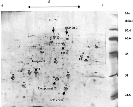 sperm-generally-have-no-surface-antigens