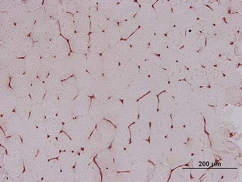 A negative control taken from another individual showing normal MHC-I staining.