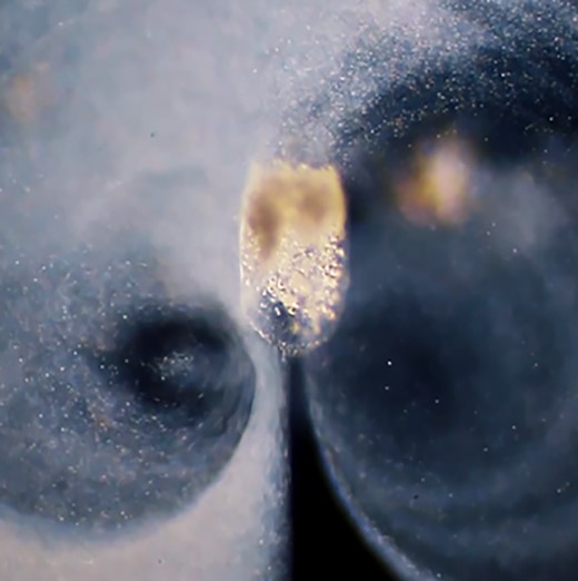 Video 1st Prize. Rotifer. Rotifer Stylonchia interacting with particles (dark-field light microscopy). Image by Tommy Gunn, New York, NY.