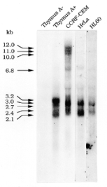  Northern blot analysis of human ET RNA species. Non-polyadenylated (thymus A − , 20 µg/lane) and polyadenylated (thymus A + , CCRF-CEM, HeLa, HL60, 20 µg/lane) RNA samples of human origin were hybridized with the 32 P-labelled DNA probe A. Transcripts detected in the different samples are indicated by arrows. Sizes are in kilobases. 