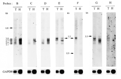  Characterization of the alternative ET RNA species. Northern blot analyses of polyadenylated human thymic (T) and HeLa (H) RNA samples (10 µg/lane) were performed with the indicated 32 P-labelled probes. The size of the detected transcripts is indicated in kilobases. GAPDH was used as an internal control to normalize for variations in RNA amounts. 