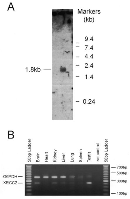  Expression of the mouse XRCC2 gene. (A) Northern analysis of 20 µg mRNA from L929 mouse cells (centre lane), probed with the full-length XRCC2 gene. The transcript size is indicated to the left. (B) RT-PCR of mouse tissue RNA, with GAPDH as a control; amounts of RNA used were 3 ng ( GAPDH ) and 4 µg ( XRCC2 ). 