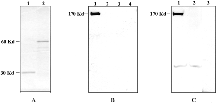 Figure 7. Interaction between WRN and PCNA proteins. (A) SDS–PAGE analysis of purified recombinant GST and GST–PCNA proteins. The glutathione-affinity purified proteins (1 µg each) were resolved on a 12% SDS–PAGE gel and stained with Coomassie blue. The approximate sizes of the proteins (GST, 30 kDa; GST–PCNA, 60 kDa) are indicated. (B) WRN–PCNA interaction detected by affinity chromatography. Glutathione-Sepharose beads containing 1 µg immobilized GST–PCNA (lanes 1 and 3) or GST (lanes 2 and 4) were used to pull down proteins from1 ml lysate prepared from insect cells infected with a WRN (lanes 1 and 2) or a Mock (lanes 3 and 4) recombinant baculovirus, as described in Materials and Methods. The interacting proteins were resolved by 10% SDS–PAGE and analyzed by western blotting using an anti-WRN antibody. (C) WRN–PCNA interaction detected by co-immunoprecipitation. WRN (0.5 µg) protein was incubated with 0.5 µg of GST–PCNA (lane 1), GST (lane 2) or GST–TIN2 (lane 3) protein and immunoprecipitated using an anti-GST antibody. The precipitated proteins were resolved by 10% SDS–PAGE, and analyzed by western blotting.