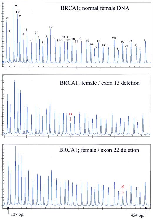 Figure 5. Detection of BRCA1 exon deletions by MLPA. Samples containing ∼100 ng DNA were analysed by MLPA using probe mix P002. Female control DNA was obtained from Promega. Blood-derived DNA from individuals known to contain an exon 13 or an exon 22 deletion were provided by the Department of Clinical Genetics, Free University of Amsterdam. Reactions were analysed by capillary electrophoresis. Probe mix P002 contains 34 probes. Nine probes recognising non-BRCA1 sequences on various chromosomes are indicated by a ‘c’. The exon recognised by the BRCA1-specific probes is indicated by a number. Probes for both alternative exons 1 are indicated as 1A and 1B. Exon 4 is not present in the normal BRCA1 gene transcript. Two probes specific for the first and last parts of exon 11 are included as this exon is very large (3.4 kb). Exon deletions are apparent by an ∼50% reduction in peak area of a specific probe. The exact gene and sequence recognised by each probe of the P002 probe mix can be found on the www.mrc-holland.com website. 