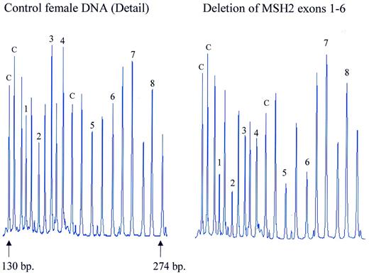 Figure 6. Detection of MSH2 exon deletions by MLPA. Samples containing ∼100 ng DNA were analysed by MLPA using probe mix P003. Female control DNA was obtained from Promega. Blood-derived DNA from an individual known to contain a deletion of exons 1–6 of the MSH2 gene was provided by the Department of Clinical Genetics, Free University of Amsterdam. Reactions were analysed by capillary electrophoresis (Beckman CEQ2000). Probe mix P003 contains 42 probes. Probes are present for each of the 19 MLH1 and each of the 16 MSH2 exons. Seven probes recognise other sequences on various chromosomes. Only part of the electropherogram is shown. The exon recognised by the MSH2-specific probes is indicated by a number. Control probes are indicated by a ‘c’. The remaining probes are specific for MLH1 exons 1–9. Exon deletions are apparent by an ∼50% reduction in peak area of a specific probe. The exact gene and sequence recognised by each probe of the P003 probe mix can be found at the www.mrc-holland.com website. 