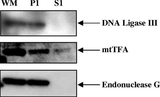 Western blot showing detection of DNA ligase III, mitochondrial transcription factor A (mtTFA) and endonuclease G in the P1 fraction of GM1310 mitochondria.