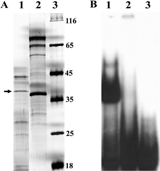 Partial purification of P.pastoris SSB. (A) Analysis of DEAE flow through (lane 1) and eluate (lane 2) fractions by SDS–PAGE followed by Coomassie blue staining of the gel. Lane 3, protein molecular weight markers (kDa). A protein band of ∼37 kDa which was excised and sequenced is indicated by an arrow. (B) EMSA of DEAE flow though (lane 1) and eluate (lane 2) fractions using 5′ end-labelled 229 probe. Lane 3, free probe.