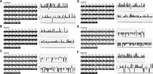 Experimental validation of representative genes in the HCC gene set. For each gene, the semi-quantitative RT–PCR results in 45 HCC pairs are presented in gel images (left), in quantified expression profiles after normalization with β-actin expression as internal control (upper right) and in comparison with expression profiles of the gene in re-analyzed Stanford HCC microarray data from expression view of OncoDB.HCC (lower right). (A) AURKA is a positive control for HCC data process; (B and C) genes selected from criteria of significant expression difference in at lease three independent microarray/proteomic studies; and (D–F) genes selected with criteria of at least 2-fold expression difference in at least 70% of paired arrays in re-analyzed Stanford HCC microarray data.