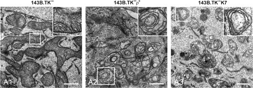 Ultra-structural investigation of wild-type and ρ 0 mitochondria by TEM. Electron micrographs of ultra-thin sections are shown. 143B.TK − wild-type mitochondria show an interconnected network structure with numerous regular arranged cristae ( A1 ). The mitochondria of 143B.TK − ρ 0 ( A2 ) and 143B.TK − K7 cells ( A3 ) demonstrate single vesicular organelles with distorted cristae, lying in concentric double membrane rings in the matrix. The insets show higher magnifications of the boxed areas. Bars (A1–A3), 1 µm.