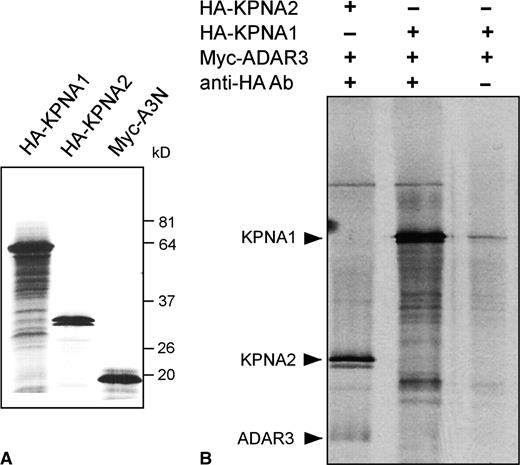 In vitro interaction of ADAR3N with KPNA2 but not KPNA1. (A) Expression of in vitro transcribed importin alpha proteins KPNA1 and KPNA2, as well as the ADAR3 protein A3N. Importin proteins carry the HA epitope tag, the ADAR protein a myc epitope tag. (B) Co-immunoprecipitation of importin/ADAR mixtures using a monoclonal anti-HA-tag antibody. In addition to KPNA2 protein, ADAR3N is co-immunoprecipitated (lane 1), but not when omitting the HA-tag specific antibody (lane 3). KPNA1 is not able to co-precipitate ADAR3N (lane 2).