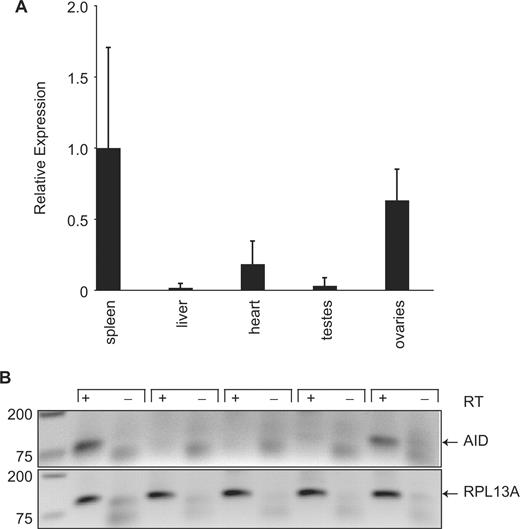 Tissue distribution of AID expression. (A) A quantitative analysis of AID mRNA expression in mouse spleen, heart, liver, testes and ovaries in relation to RPL13A (housekeeping gene control) mRNA in the same samples. Spleen was normalized to 1.0. Tissues from two or three animals were procured and each sample was analyzed in triplicate. The standard deviations are shown. (B) Agarose gel images of the PCR products from the qPCR. DNA marker sizes are indicated on the left in base pairs. RT, reverse transcriptase.