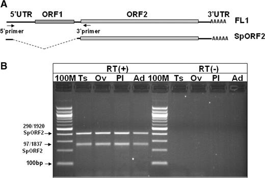 Various adult human tissues support production of the spliced L1 transcript that has a potential to produce ORF2 protein. ( A ) Schematic of the full-length L1 element (FL1) and the spliced ORF2 transcript (SpORF2). Arrows indicate the positions of the RT–PCR primers. ( B ) RT–PCR analysis of the L1 splice products in human Ts, testis; Ov, ovary; Pl, placenta; Ad, adrenal gland. RT(+) and RT(−) panels indicate reactions with and without RT, respectively. 100 M, 100 bp marker. The two differentially migrating bands represent L1 splice products utilizing various L1 splice donor and acceptor sites (indicated on the left).