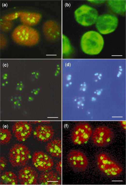 Chloroplasts from tobacco leaf mesophyll cells in water-mounted tissue visualized by confocal or epifluorescence microscopy. (a,b,e,f) Chloroplasts viewed by laser scanning confocal microscopy (TCS-NT, DMRXA light microscope stand, Leica Microsystems Wetzlar GmbH). Images of GFP and chlorophyll fluorescence, using an excitation wavelength of 488 nm, were collected through TRITC and FITC filters, respectively. Images (a), (e) and (f) result from merging chlorophyll and GFP fluorescence. Image (b) shows GFP fluorescence only. ( a ) GFP-LacI line showing the appearance of plastid DNA as fluorescent nucleoids (bar = 2.8 µm). ( b ) P rrn::gfp line showing GFP fluorescence distributed throughout the chloroplasts (bar = 2.8 µm). (c,d) Leaf tissue from a lacO /GFP-LacI line stained with DAPI and viewed by epifluorescence microscopy. ( c ) GFP fluorescence (bar = 2 µm). ( d ) DAPI fluorescence of the same cells, merged with GFP fluorescence, showing co-localization of GFP and DAPI-stained DNA (bar = 2 µm). ( e ) LacI-GFP line showing the appearance of plastid DNA as fluorescent nucleoids (bar = 2.8 µm). ( f ) lacO /GFP-LacI line showing fluorescent nucleoids (bar = 2.8 µm).