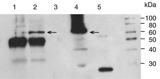 Immunoblot of immunoprecipitated protein obtained by incubation of lysed chloroplast extracts with or without antibody prior to addition of protein-A Sepharose, elution of the protein–DNA complexes from the protein-A Sepharose and subsequent precipitation in ethanol. The precipitates were solubilized in 10 mM Tris–HCl pH 7.6 and 25–35 µl fractionated by electrophoresis on a SDS-10% polyacrylamide gel, blotted onto nitrocellulose and incubated with rabbit polyclonal anti-GFP. Immunoreactive bands were detected by enhanced chemiluminescence. Lane 1, rabbit anti- A. thaliana TTG1; lane 2, rabbit anti-GFP; lane 3, no antibody; lane 4, total soluble protein; lane 5, 50 ng recombinant GFP. Arrows mark the position of the GFP-LacI monomer at 66 kDa. A marker lane is shown to the right.