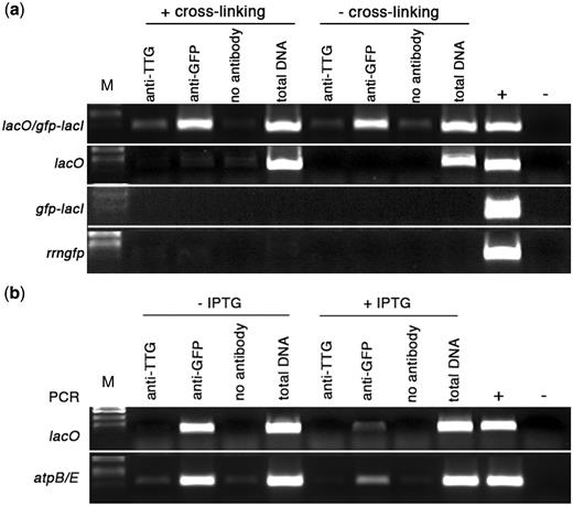 Binding of GFP-LacI to chloroplast-located lacO sequences. ( a ) PCR analysis of immunoprecipitated chloroplast DNA. Immunoprecipitation was carried out with the following treatments: antibody to A. thaliana TTG1, antibody to GFP or no antibody. Total DNA was extracted from a fraction of the chloroplast lysate that did not undergo immunoprecipitation. Control reactions for PCR included genomic DNA isolated from a transplastomic lacO line (+) and water (−). M, DNA size markers. (a) Binding of GFP-LacI to lacO. Primers were used to amplify a 409-bp sequence, which includes plastid-localized lacO (marked as position 3 in Figure 1(a). Experimental lines are listed on the left. Treatments shown in the left half of the panel were carried out following formaldehyde cross-linking, those on the right were not subjected to formaldehyde cross-linking. ( b ) Effect of IPTG on binding of GFP-LacI to lacO. PCR analysis of immunoprecipitated chloroplast DNA from lacO /GFP-LacI lines, using primers to amplify a 409-bp fragment encompassing lacO and a 396-bp fragment from atpBE (shown on left side). Treatments shown in the left half of the panel were carried out in the absence of IPTG, those in the right half were carried out in the presence of 20 mM IPTG.