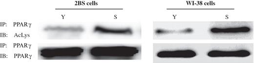 Acetylation levels of PPARγ in young and senescence 2BS and WI-38 cells. PPARγ was immunoprecipitated from protein lysates using PPARγ antibody, and acetylation levels of PPARγ were determined by western blot analysis using an antibody that recognizes acetyl-lysine (Ac-lys) residues.