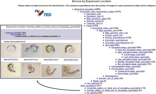 FlyTED browse results, presented as an array of captioned image thumbnails, for the gene expression location Cup-like_pattern_of_dismal_end_of_elongating_spermatids.