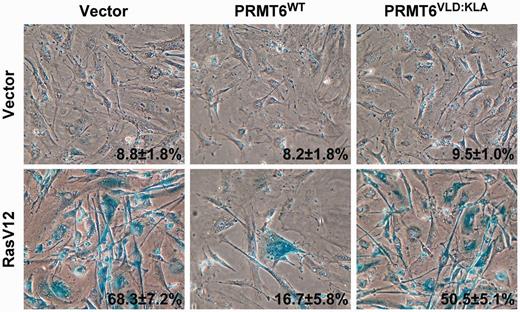  The methyltransferase activity of PRMT6 is required to bypass Ras-induced senescence. Rescue of RasV12-induced senescence using wild-type PRMT6 (PRMT6 WT ) but not a methyltransferase inactive PRMT6 (PRMT6 VLD:KLA ). The percent and standard deviation of SA-β-Gal-positive cells are indicated at the bottom right of each panel. Data represent three independent measurements done with cells fixed 14 day post-selection. 