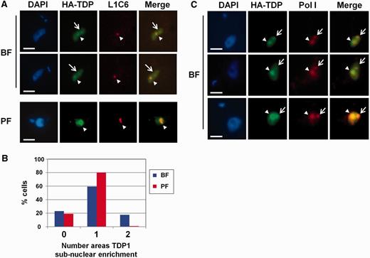 TDP1 is predominantly located in the Pol I-enriched nucleolus and ESB. ( A ) Panels show representative HA-TDP1 expressing bloodstream form (BF) or procyclic form (PF) cells stained with the DNA stain DAPI. Cells were reacted with an anti-HA antibody to visualize HA-TDP1 or with an antibody against the nucleolar marker L1C6 to visualize the Pol I-enriched nucleolus. The merged images are shown on the right. Arrowheads show TDP1 and L1C6 enriched spots corresponding to the nucleolus. Arrows indicate additional subnuclear TDP1 enriched spots not corresponding with the nucleolus. Scale bars indicate 2.5 µm. ( B ) Percentage of cells with different numbers of distinct TDP1 containing subnuclear spots in BF or PF T. brucei . The mean of two experiments is shown with ∼100 cells analysed per experiment. ( C ) TDP1 co-localizes with Pol I in T. brucei . The panels are as in panel A, only an antibody against the T. brucei RPA1 was used (Pol I). Merged images are shown on the right. Arrowheads show areas of TDP1 enrichment corresponding with the nucleolus, whereas arrows indicate the additional subnuclear areas of TDP1 enrichment corresponding to the ESB. Scale bars indicate 2.5 µm.