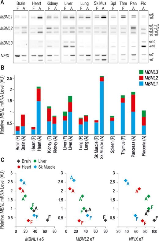 Expression pattern of MBNL mRNAs in different tissues and consequences on alternative splicing. Representative images of semi-quantitative reverse transcriptase-polymerase chain reaction (RT-PCR) analyses of MBNL1 exon 5, MBNL2 exons 6 and 7, MBNL3 exon 10 and NFIX exon 7 distribution (+e, PCR band representing exon inclusion and –e, representing exon exclusion) (A) and multiplex PCR-based quantification of relative MBNL1, 2 and 3 as well as total MBNL mRNA in various tissues (B). Human fetal (F) and adult (A) cDNA panels from Clontech were used as templates for PCRs. Note the predominant MBNL1 transcript expression in most tissues, especially in the adult skeletal muscle. Relatively high amounts of MBNL2 are detected in the brain, and MBNL3 in the liver and placenta. In (C) inclusion of MBNL1 exon 5, MBNL2 exon 7 and NFIX exon 7 was related to the total amount of MBNL mRNA. Note that with increasing amounts of MBNLs during differentiation, the splicing shifts toward MBNL-dependent exon exclusion in all depicted tissues. In contrast, splicing of MBNL2 exon 6 does not depend on MBNL content, as exon 6 is specifically included only in the brain and pancreas [see images in (A)]. AU indicates arbitrary units (P. Konieczny and K. Sobczak, unpublished data).