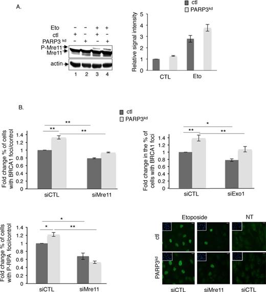 Extensive end resection in the PARP3-depleted cells is mediated by CtIP/Mre11 and Exo1 activities. (A) PARP3-depleted cells display increased etoposide-induced phosphorylation of Mre11. Control (ctl) and PARP3kd cells were mock-treated (lanes 1–2) or treated with etoposide (50 μM, 1 h, lanes 3–4) and harvested for Mre11 and actin immunoblotting (left panel). The DNA damage-induced phosphorylation of Mre11 induces a mobility shift that is enhanced in PARP3kd cells. Experiments were performed three times giving similar results (right panel). The relative signal intensities of the phosphorylated versus unphosphorylated Mre11 were measured in the three independent experiments using ImageJ. Mean values ±SD are indicated. (B) Extensive DNA end resection in the PARP3kd cells is partially rescued by the additional depletion of Mre11 or Exo1. Control (ctl) and PARP3-depleted cells (PARP3kd) were transfected with the indicated siRNA for 48 h, treated with etoposide (50 μM) for 1 h, released in fresh medium for 5 h and processed for BRCA1 (upper panel) and P-RPAS4S8 staining (lower panel). The histograms depict the fold change in the number of cells displaying >10 BRCA1 or >100 P-RPAS4S8 foci relative to the control. For each experiment, an average of 500 cells per condition were scored in > 20 randomly selected fields. Data are represented as the means of three independent experiments ±SD. *P < 0.05; **P< 0.01. Representative immunofluorescences of the quantification of the positive cells with P-RPAS4S8 foci (green) are shown. Insets: nuclei are stained in blue with DAPI. Note the similar pattern of cells with >100 P-RPAS4S8 foci in both cell lines.