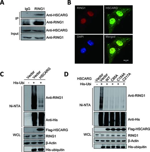 HSCARG interacts with RING1 and inhibits RING1 ubiquitination. (A) Endogenous interaction of HSCARG with RING1. HEK293T cells were harvested 48 h after seeding, and 5% of the cell lysates were analyzed directly (input). The remaining cell lysates were immunoprecipitated with anti-RING1 antibody or control rabbit IgG, followed by western blot with anti-RING1 and anti-HSCARG antibodies. (B) Co-localization of RING1 and HSCARG in HeLa cells. Subcellular localization of endogenously expressed RING1 and HSCARG was visualized by immunofluorescence microscopy using anti-RING1 antibody (red), anti-HSCARG antibody (green) and DAPI (blue). Scale bar, 10 μm. (C) and (D) HSCARG inhibits endogenous RING1 ubiquitination. HEK293T cells were transfected with indicated plasmids. At 48 h after transfection, cells were lysed with denaturing buffer and incubated with Ni-NTA beads, and the ubiquitinated proteins were purified and subjected to western blot with the indicated antibodies.