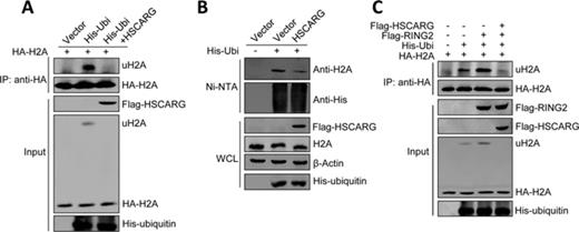 HSCARG inhibits PRC1-mediated H2A ubiquitination. (A) HSCARG suppresses H2A ubiquitination. HEK293T cells were transfected with HA-H2A, His-ubiquitin and Flag-HSCARG as indicated. Forty-eight hour later, cells were harvested and lysed in denaturing buffer, and H2A conjugates were isolated by immunoprecipitation using the anti-HA antibody and protein G. The bound complexes were analyzed by western blot with anti-His and anti-HA antibodies. (B) HSCARG inhibits endogenous H2A ubiquitination. HEK293T cells were transfected with His-ubiquitin and Flag-HSCARG as indicated. Forty-eight hour later, His-ubiquitin pull-down analysis was performed using indicated antibody. (C) HSCARG reduces RING2-catalyzed H2A ubiquitination. HEK293T cells were transfected with HA-H2A, His-ubiquitin, Flag-HSCARG and Flag-RING2 as indicated. Forty-eight hour later, the levels of ubiquitinated H2A were monitored by denaturing immunoprecipitation analysis as previously described followed by western blot with indicated antibodies.