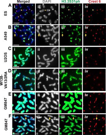 Localization of H3.3S31ph on the chromosome arms in human ALT cancer cell lines. Immunofluorescence analysis was performed using antibodies against H3.3S31ph (green) and centromeres (human Crest antibody; red). (A) H3.3S31ph localizes at the telomeres in mouse ES cells (arrowhead). (B) In telomerase-positive A549 cells, H3.3S31ph is enriched at the pericentric satellite DNA repeats (arrow). No significant enrichment is observed on the chromosome arms. (C–D) In ALT-positive U2OS and W138-VA13/2RA cancer cells, H3.3S31ph is found at extremely high levels at the pericentric DNA repeats and across the chromosome arms. No clear enrichment of H3.3S31ph was found at the telomeres when compared to signal on the chromosome arms. (E–F) In GM847 ALT cancer cells, a high level of H3.3S31ph is also detected on the pericentric DNA repeats and chromosome arms. A lower exposure (F) indicates a slightly higher intensity of H3.3S31ph at the pericentric DNA repeats (arrow). Representative images of 50 chromosome spreads are shown. Scale bar = 5 μm.