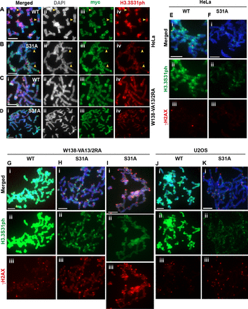 Substitution of the Serine 31 with an alanine residue alters the H3.3 S31ph staining pattern in ALT-positive cancer cells. (A–D) HeLa and W138-VA13/2RA cells were transfected with wild-type (WT) mycH3.3 and mutant mycH3.3S31A (S31A) DNA constructs, and immunofluorescence analysis was performed with antibodies against myc (green) and H3.3 S31ph (red) 96 h post-transfection. (A–B) In HeLa cells expressing WT myc-H3.3, H3.3S31ph was clearly detectable at the pericentric satellite DNA repeats on mitotic chromosomes. When the Serine 31 of H3.3 was substituted with an Alanine and over-expressed in cells, the level of H3.3S31ph at the pericentric DNA repeats was reduced. (C–D) Unlike the expression of WT myc-H3.3, over-expression of the H3.3S31A mutant in W138-VA13/2RA ALT cells led to a significant reduction in H3.3S31ph level at the pericentric DNA repeats and on chromosome arms. (E–K) Immunofluorescence analysis was performed with antibodies against H3.3S31ph (green) and γH2AX (red) on HeLa, W138-VA13/2RA and U2OS cells expressing either WT myc-H3.3 or mutant H3.3S31A. (E–F) The intensities of γH2AX on the mitotic chromosomes were low in HeLa cells expressing WT mycH3.3 and mycH3.3S31A mutant, respectively. (G–K) In W138-VA13/2RA cells, the over-expression of myc-H3.3S31A led to increases in γH2AX signals on the chromosomes arms (H) and at the telomeres (I). In U2OS cells, there was no significant increase in γH2AX staining on the chromosome arms; however, there was a significant increase in telomeric foci showing positive γH2AX signals (K). Representative images of 50 chromosome spreads are shown. Scale bar = 5 μm.